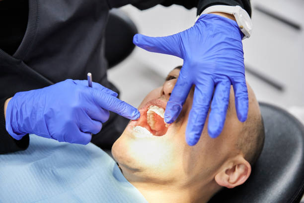 Best Emergency Root Canal Therapy in Reston, VA